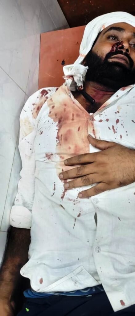 दीपावली के दिन चुनावी रंजिश को लेकर मारपीट, दोषियो के विरूद्ध कार्रवाई की मांग