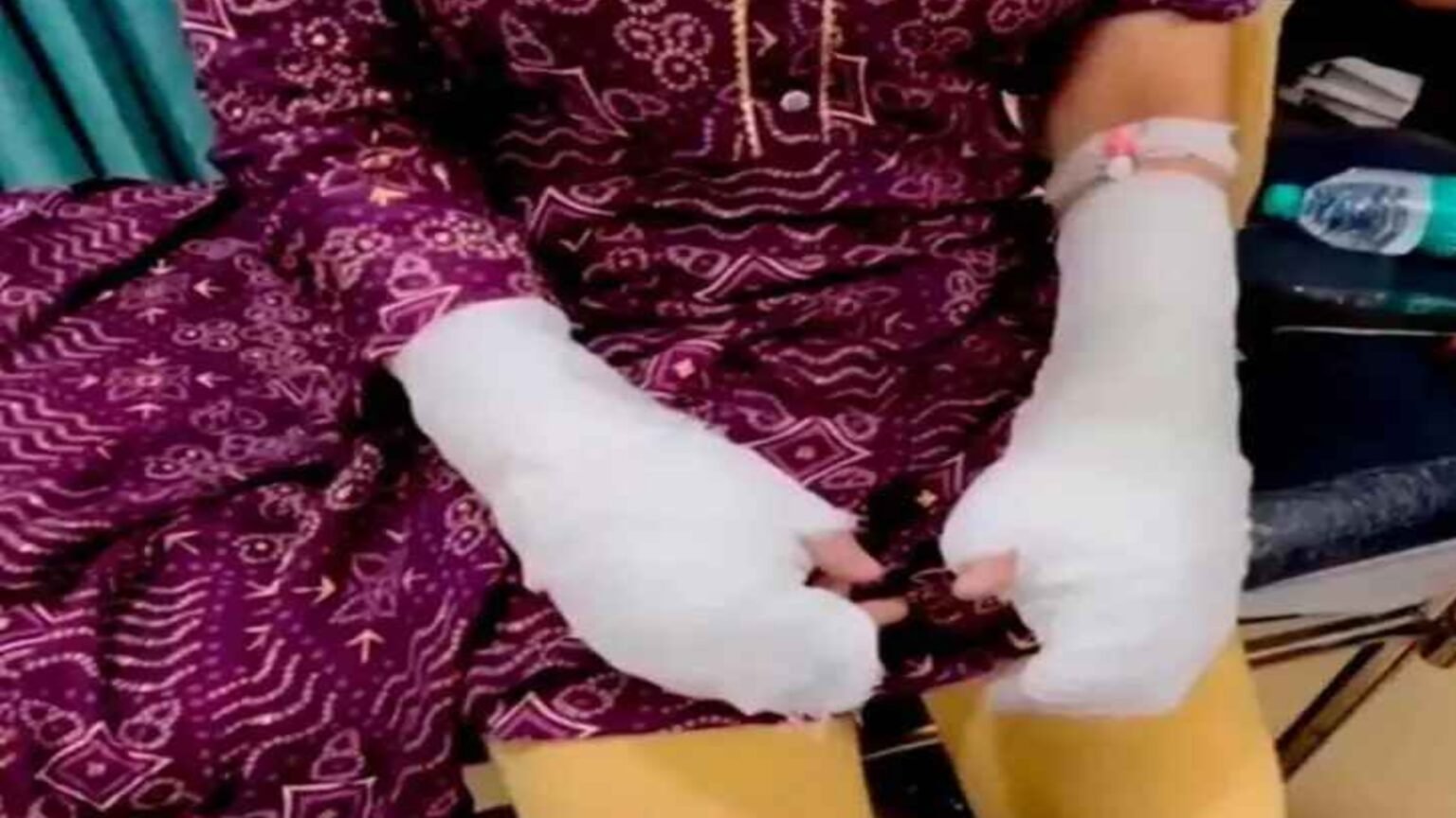 दिल्ली यूनिवर्सिटी छात्रा पर एसिड अटैक का मामला फर्जी निकला: पिता ने रची थी पूरी साजिश, 3 युवकों को फंसाने की कोशिश