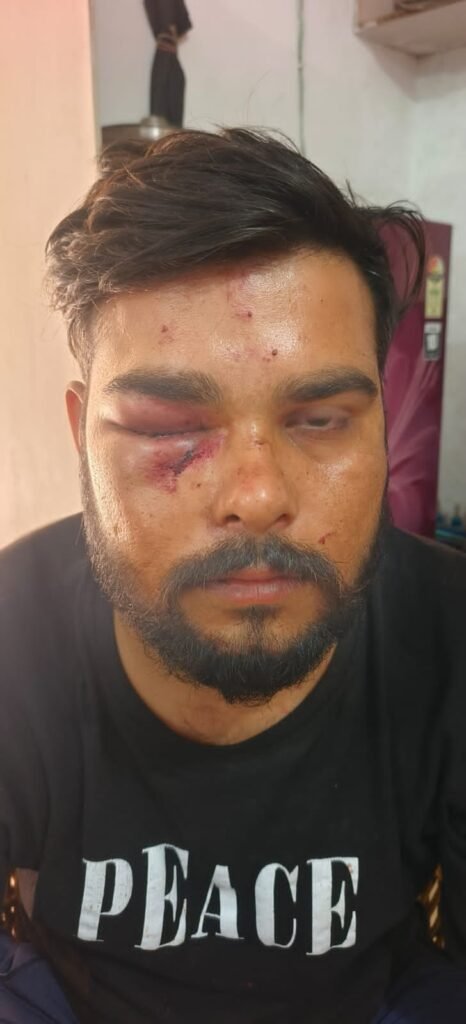 कैंटीन संचालक को आधा दर्जन युवकों ने पीटा, पीड़ित ने दी पुलिस को तहरीर