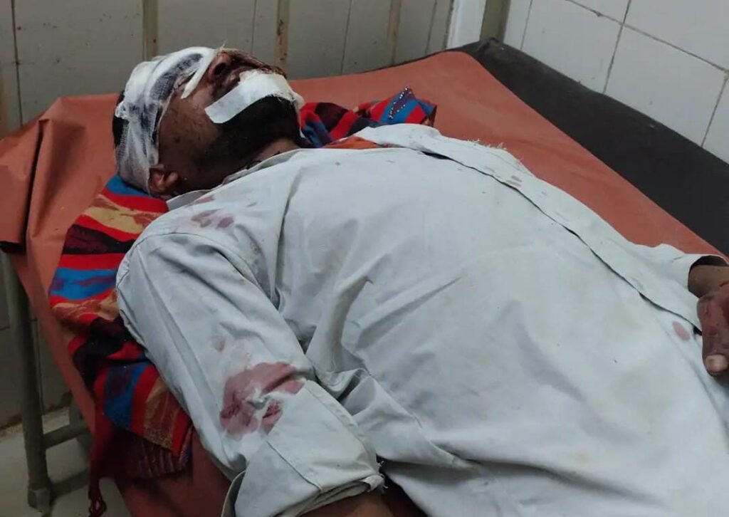 आगरा–फतेहाबाद मार्ग पर हादसा, जगराजपुर मोड़ के पास दंपति घायल