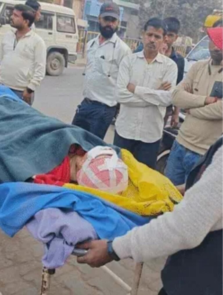 आगरा: सरप्राइज गिफ्ट के बहाने भाभी ने ननद पर बेरहमी से हमला किया, सिर पर 50 से ज्यादा वार; हालत नाजुक