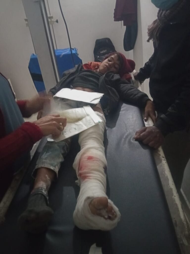 बाइक की टक्कर से 8 वर्षीय बालक गंभीर रूप से घायल, परिजनों ने तेज रफ्तार का लगाया आरोप