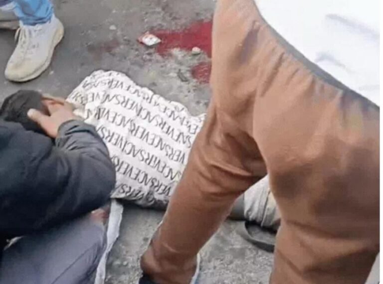 आगरा में हीलियम सिलेंडर ब्लास्ट: बोदला चौराहे पर गुब्बारे बेच रहे युवक का पैर फटा, टक्कर से हुआ हादसा