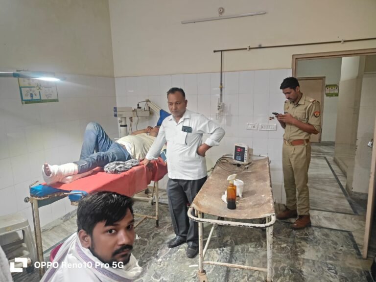 एक्सप्रेस-वे पर दो बसों की टक्कर, कंडक्टर सहित दो घायल