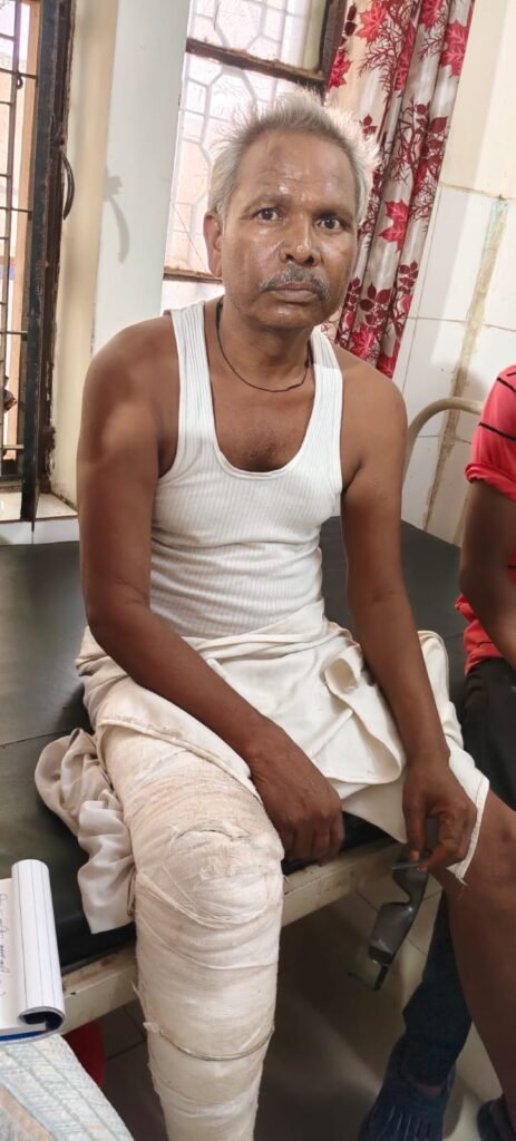पहले बड़े बेटे ने आंख में चोट मारी, अब छोटे बेटे की मारपीट में टूटा पैर